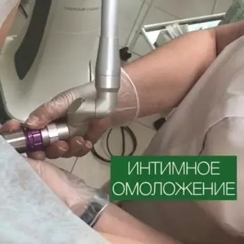 Лазер для интимного омоложения