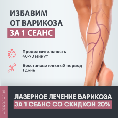 Лечение варикоза на ногах за 1 сеанс со скидкой 20%